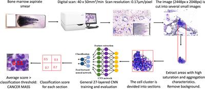 Frontiers | Detection Of Metastatic Tumor Cells In The Bone Marrow ...